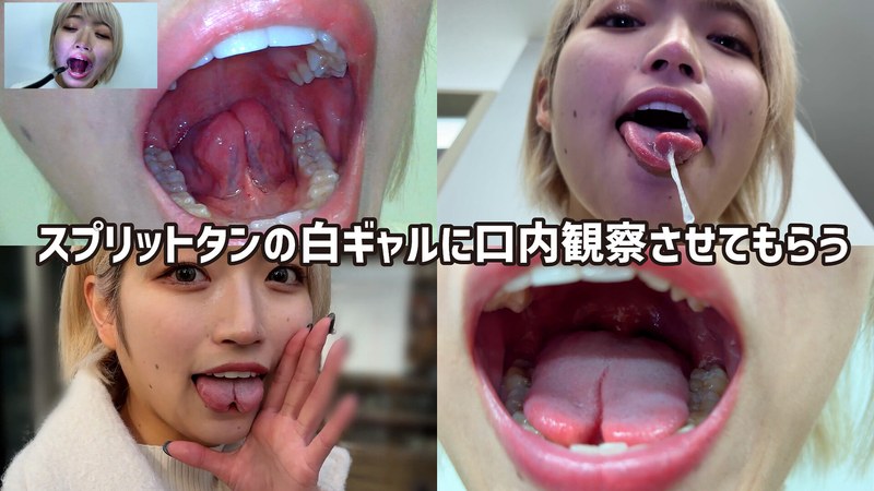 街角で声をかけて口内観察させてもらう 美容部員 はるのちゃん